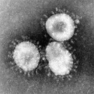 Mikroskopie des Corona-Virus