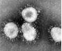 Das Coronavirus wurde für extrem viele Menschen ganz überraschend ein sehr ernstes Thema
