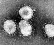 Das Coronavirus wurde für extrem viele Menschen ganz überraschend ein sehr ernstes Thema