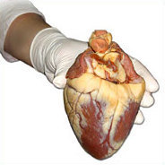 Eine Herzmuskelentzündung ist nicht leicht zu erkennen