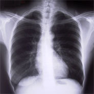 Mit der Scham einer Erkrankung umgehen